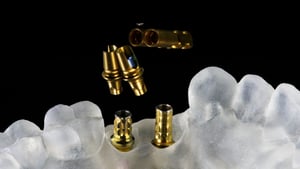 Anodizing Custom Abutments