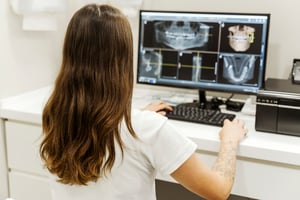CADCAM Technology in Digital Dentistry