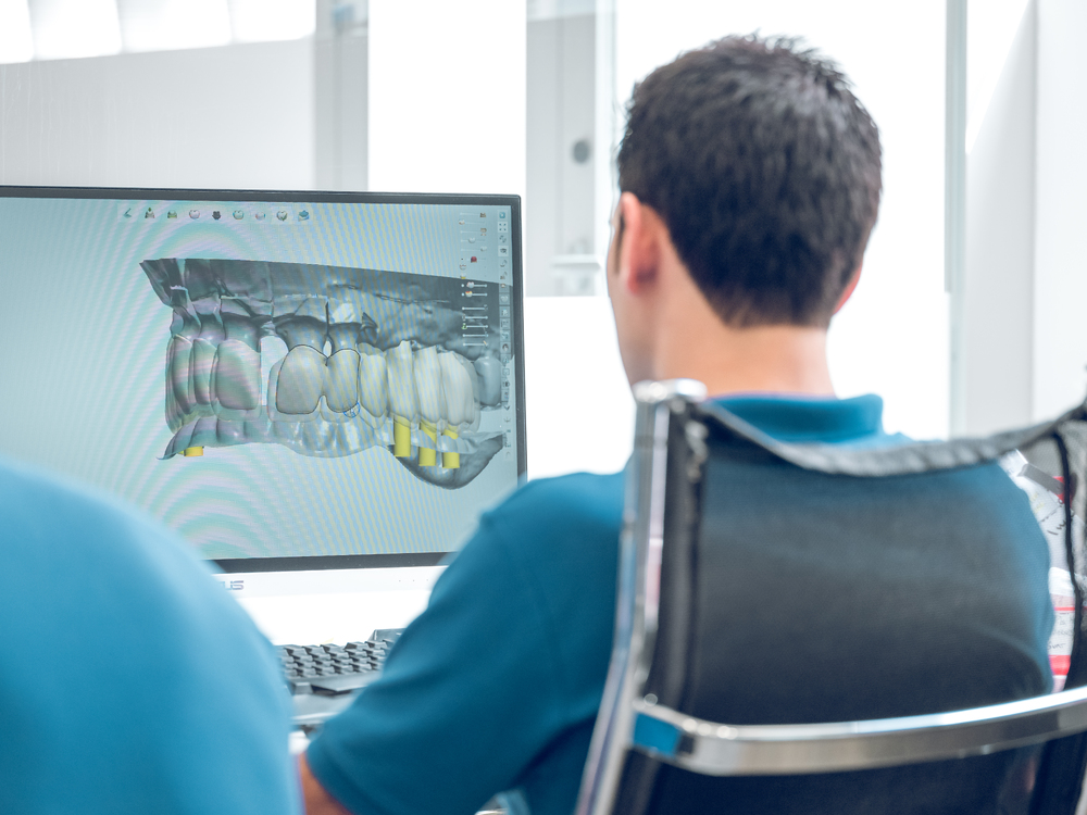 CAD CAM Crown Fabrication: Step-by-Step Technical Breakdown