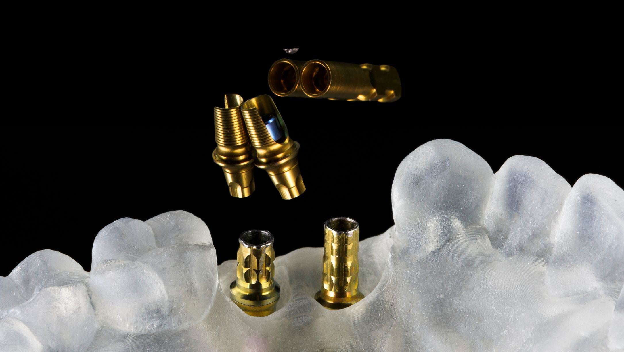 Why Is Anodizing Custom Abutments Beneficial for Patients?